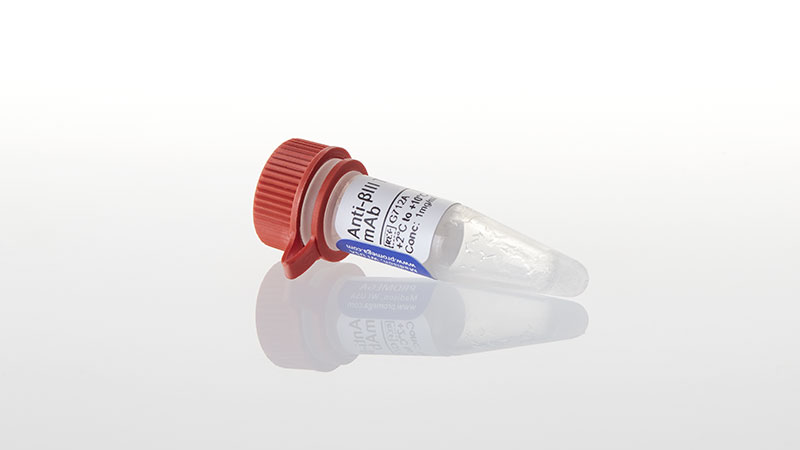 G7121_Anti-betaIII-Tubulin-mAb--100ug_3