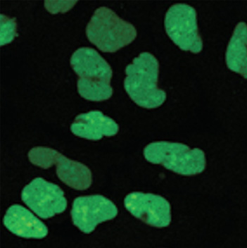 Cell image of parental U2OS cells and U2OS cells stably expressing HaloTag® protein fused to three copies of a nuclear localization sequence (labeled with Janelia Fluor® 503 HaloTag® Ligand).