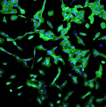 Cell image of U2OS cells stably expressing HaloTag® protein fused to three copies of a nuclear localization sequence (labeled with Alexa Fluor® 488 HaloTag® Ligand).