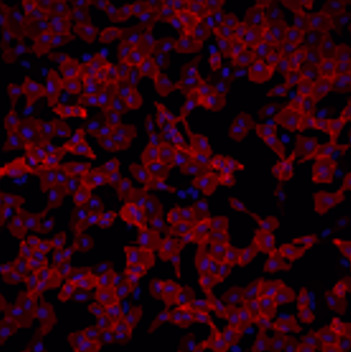 Cell image of U2OS cells stably expressing HaloTag® protein fused to three copies of a nuclear localization sequence (labeled with Janelia Fluor® 549i HaloTag® Ligand).